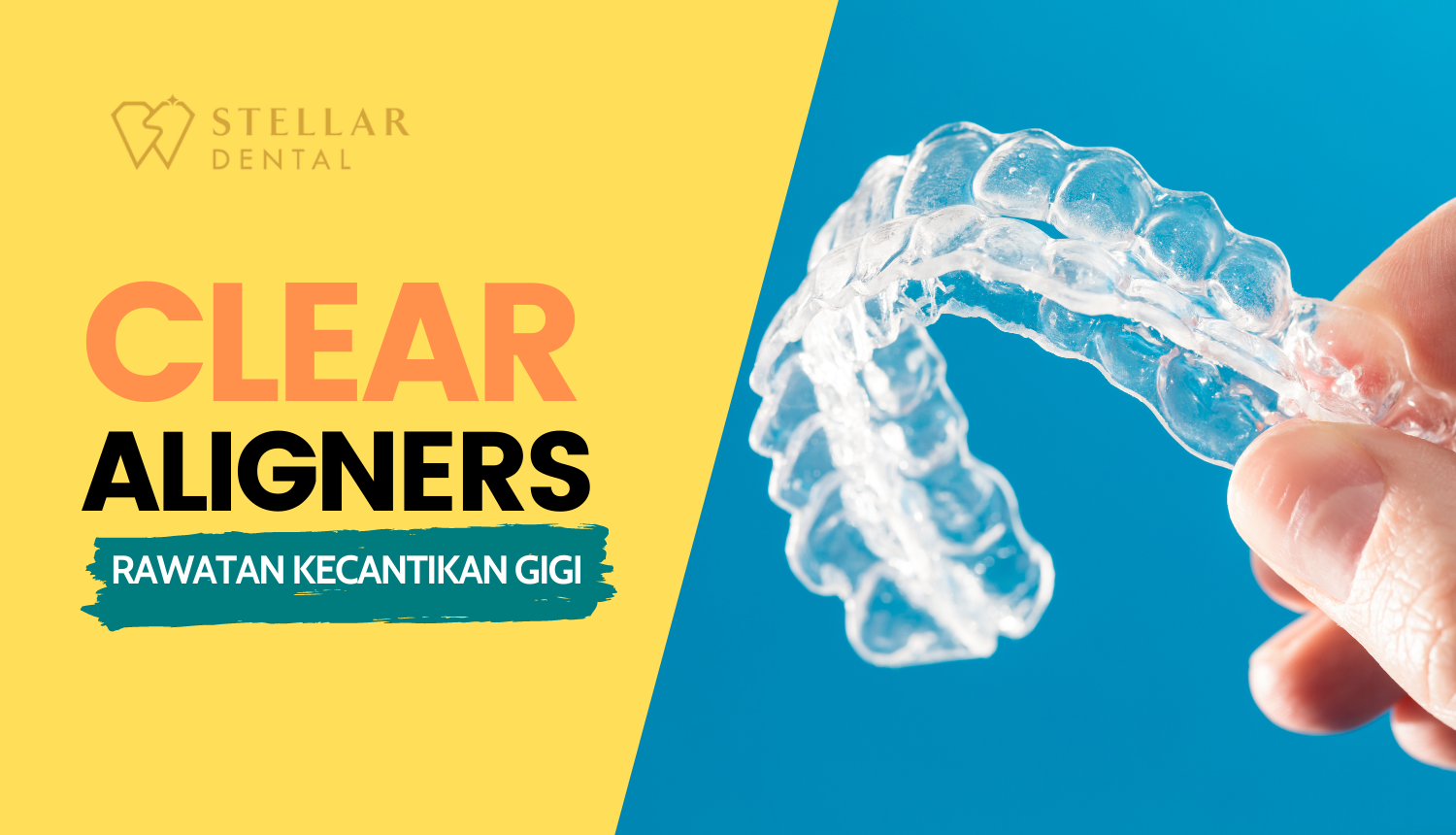 Clear Aligners Rawatan Kecantikan Gigi Stellar Dental